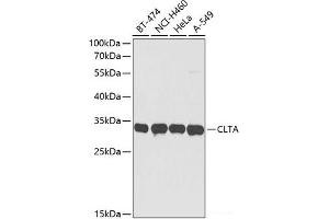Western blot analysis of extracts of various cell lines using CLTA Polyclonal Antibody at dilution of 1:3000. (CLTA 抗体)