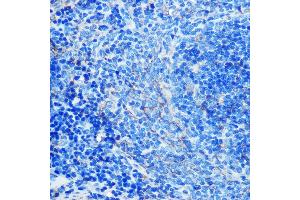 Immunohistochemistry (IHC) image for anti-Fc Fragment of IgE, Low Affinity II, Receptor For (CD23) (FCER2) antibody (ABIN7267160)