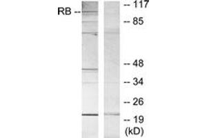 Western blot analysis of extracts from MOLT cells, using Retinoblastoma (Ab-807) Antibody. (Retinoblastoma Protein (Rb) 抗体  (AA 781-830))