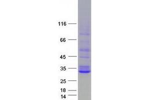 Western Blotting (WB) image for Steroidogenic Acute Regulatory Protein (STAR) (Transcript Variant 2) protein (Myc-DYKDDDDK Tag) (ABIN2732846)
