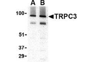 Western blot analysis of TRPC3 in human brain tissue lysate with this product at (A) 1 and (B) 2 μg/ml. (TRPC3 抗体  (C-Term))