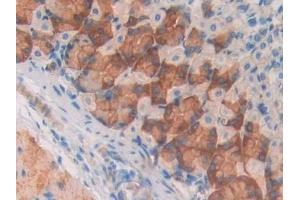 Detection of MAOA in Mouse Stomach Tissue using Polyclonal Antibody to Monoamine Oxidase A (MAOA)