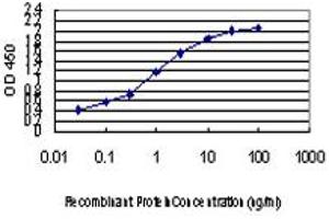 Detection limit for recombinant GST tagged ZIC4 is approximately 0. (ZIC4 抗体  (AA 249-319))