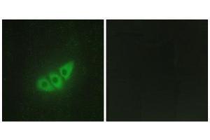 Immunofluorescence (IF) image for anti-Eukaryotic Translation Initiation Factor 2-alpha Kinase 3 (EIF2AK3) (N-Term) antibody (ABIN1850024) (PERK 抗体  (N-Term))