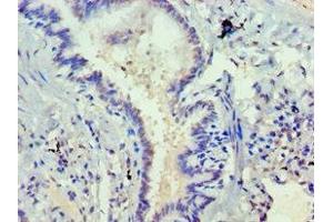 Immunohistochemistry of paraffin-embedded human lung tissue using ABIN7168752 at dilution of 1:100 (DVL2 抗体  (AA 1-240))