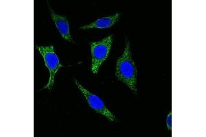 Confocal immunofluorescence analysis of methanol-fixed Eca-109 cells using Cytokeratin (Pan) antibody (green), showing cytoplasmic localization. (pan Keratin 抗体)