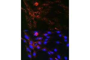 Immunofluorescence (IF) image for anti-Tubulin, gamma 1 (TUBG1) antibody (ABIN7271052)