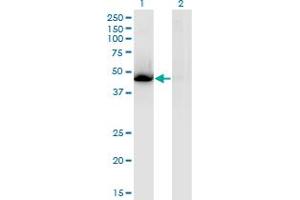 Western Blot analysis of NR1H3 expression in transfected 293T cell line by NR1H3 monoclonal antibody (M08), clone 3E9. (NR1H3 抗体  (AA 1-387))