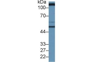 Rabbit Capture antibody from the kit in WB with Positive Control: Human serum. (SLC3A2 ELISA 试剂盒)