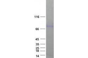 Western Blotting (WB) image for Sphingomyelin phosphodiesterase 1, Acid Lysosomal (SMPD1) (Transcript Variant 1) protein (Myc-DYKDDDDK Tag) (ABIN2732260)