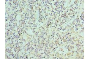 Immunohistochemistry of paraffin-embedded human spleen tissue using ABIN7145108 at dilution of 1:100 (ATG16L1 抗体  (AA 90-300))