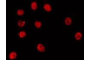 ABIN6274251 staining HepG2 by IF/ICC. (ETV6 抗体  (Internal Region))