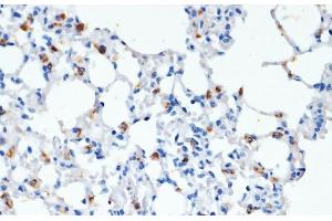 Immunohistochemistry (Paraffin-embedded Sections) (IHC (p)) image for anti-Surfactant Protein C (SFTPC) antibody (ABIN7259843)