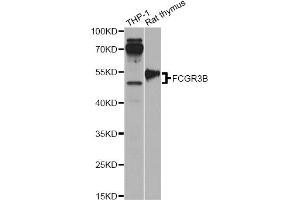 Western blot analysis of extracts of various cell lines, using FCGR3B antibody. (FCGR3B 抗体)