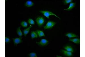 Immunofluorescence staining of A549 cells with ABIN7170898 at 1:100, counter-stained with DAPI. (Sdhaf2 抗体  (AA 30-166))
