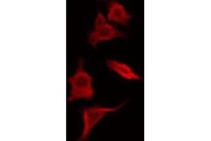 ABIN6266583 staining HepG2 by IF/ICC. (SCGB2A1 抗体  (Internal Region))