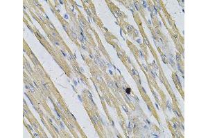 Immunohistochemistry of paraffin-embedded Rat heart using PRNP Polyclonal Antibody at dilution of 1:100 (40x lens). (PRNP 抗体)