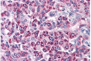 Human Pancreas: Formalin-Fixed, Paraffin-Embedded (FFPE) (TLR3 抗体  (AA 514-657))