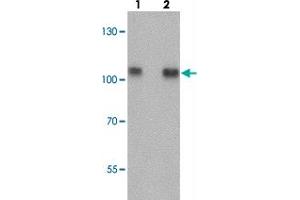 Western blot analysis of TRIM24 in EL4 cell lysate with TRIM24 polyclonal antibody  at (lane 1) 0. (TRIM24 抗体  (Internal Region))