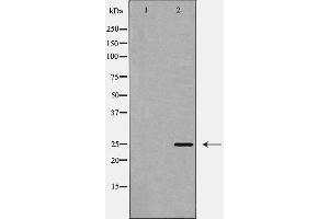 Western blot analysis of CHOP expression in Jurkat cell lysate,The lane on the left is treated with the antigen-specific peptide. (DDIT3 抗体  (Internal Region))