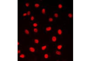Immunofluorescent analysis of CREB staining in MCF7 cells. (CREB1 抗体  (Center))