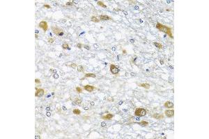 Immunohistochemistry of paraffin-embedded rat brain using DDX39A antibody at dilution of 1:100 (x40 lens). (DDX39 抗体)