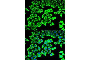 Immunofluorescence analysis of U20S cell using RPLP2 antibody. (RPLP2 抗体)