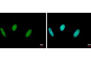 ICC/IF Image RAD18 antibody [N1C1] detects RAD18 protein at nucleus by immunofluorescent analysis. (RAD18 抗体  (Center))