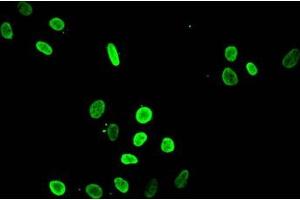 Immunofluorescent analysis of Hela cells treated with NaB using ABIN7139199 at dilution of 1:100 and Alexa Fluor 488-congugated AffiniPure Goat Anti-Rabbit IgG(H+L) (HIST1H4A 抗体  (acLys8))