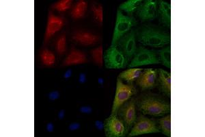 ABIN6259163 and ABIN6274159 staining  cells by IF/ICC.