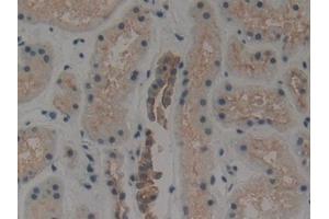Detection of CK1 in Human Kidney Tissue using Polyclonal Antibody to Cytokeratin 1 (CK1) (Cytokeratin 1 抗体  (AA 487-644))