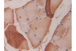 Detection of FBN1 in Rat Skeletal muscle Tissue using Polyclonal Antibody to Fibrillin 1 (FBN1) (Fibrillin 1 抗体  (AA 751-895))