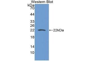 Detection of Recombinant CD276, Mouse using Polyclonal Antibody to Cluster Of Differentiation 276 (CD276) (CD276 抗体  (AA 47-213))