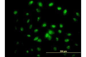 Immunofluorescence of monoclonal antibody to IFRD2 on HeLa cell. (IFRD2 抗体  (AA 1-442))