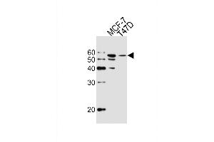 Western blot analysis of lysates from MCF-7, T47D cell line (from left to right), using ALDH6A1 Antibody (ABIN659006 and ABIN2838041).
