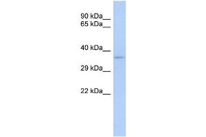 WB Suggested Anti-TRADD Antibody Titration:  0. (TRADD 抗体  (Middle Region))