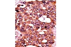 Image no. 2 for anti-Cell Division Cycle 6 Homolog (S. Cerevisiae) (CDC6) (pSer54) antibody (ABIN358103) (CDC6 抗体  (pSer54))