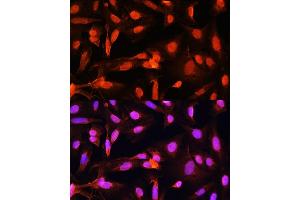 Immunofluorescence analysis of U20S cells using SGOL1 antibody (ABIN7270288) at dilution of 1:100. (Shugoshin 抗体  (AA 10-100))