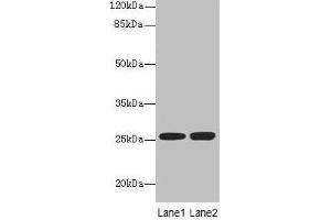 Western blot All lanes: EEF1AKMT1 antibody at 10 μg/mL Lane 1: Jurkat whole cell lysate Lane 2: 293T whole cell lysate Secondary Goat polyclonal to rabbit IgG at 1/10000 dilution Predicted band size: 25 kDa Observed band size: 25 kDa (EEF1A Lysine Methyltransferase 1 (EEF1AKMT1) (AA 2-214) 抗体)