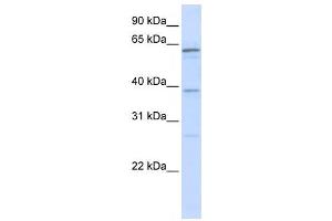 Western Blotting (WB) image for anti-RNA Binding Motif Protein 39 (RBM39) antibody (ABIN2458513) (RBM39 抗体)