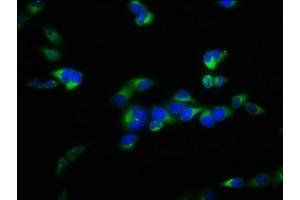 Immunofluorescence staining of Hela cells with ABIN7152472 at 1:100, counter-stained with DAPI. (FBXL2 抗体  (AA 1-423))