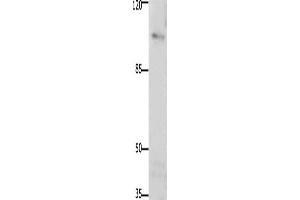 Western Blotting (WB) image for anti-PTK2 Protein tyrosine Kinase 2 (PTK2) antibody (ABIN2425840) (FAK 抗体)