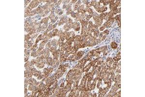 Immunohistochemical staining (Formalin-fixed paraffin-embedded sections) of human liver with TIMM8A polyclonal antibody  shows strong cytoplasmic positivity in hepatocytes. (TIMM8A/DDP 抗体)