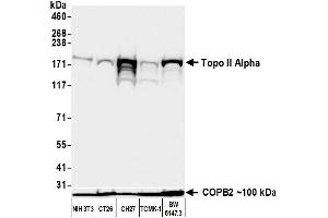 Western Blotting (WB) image for anti-Topo IIalpha (AA 650-700) antibody (ABIN7795794) (Recombinant Topo IIalpha (AA 650-700) 抗体)