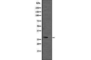 Western blot analysis of UBE2R2 expression in Jurkat whole cell lysate ,The lane on the left is treated with the antigen-specific peptide. (UBE2R2 抗体)