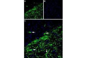 Immunohistochemistry (IHC) image for anti-Potassium Inwardly-Rectifying Channel, Subfamily J, Member 6 (KCNJ6) (AA 374-414), (Intracellular) antibody (ABIN7043487)
