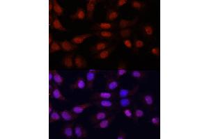 Immunofluorescence analysis of HeLa cells using N5-Methylcytidine antibody (ABIN1678489, ABIN3016020, ABIN3016022 and ABIN6219497) at dilution of 1:100. (5-Methylcytosine 抗体)