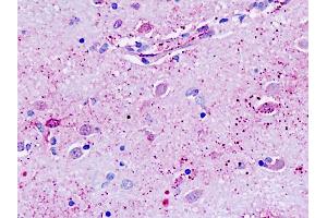 Human, Brain, neurons: Formalin-Fixed Paraffin-Embedded (FFPE) (GPR162 抗体  (Transmembrane Domain))