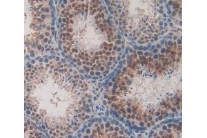 Used in DAB staining on fromalin fixed paraffin- embedded Kidney tissue (UXT 抗体  (AA 11-157))