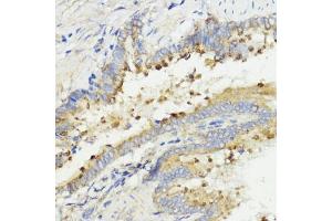Immunohistochemistry of paraffin-embedded rat lung using IGF1 antibody (ABIN6134370, ABIN6142231, ABIN6142233 and ABIN6215544) at dilution of 1:100 (40x lens). (IGF1 抗体  (AA 50-150))